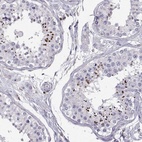 Immunohistochemical staining of human testis shows high expression.