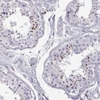 Immunohistochemical staining of human testis shows high expression.