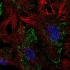 Anti-LHFPL2 Antibody