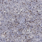 Immunohistochemical staining of human spleen shows high expression.