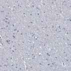 Immunohistochemical staining of human cerebral cortex shows low expression as expected.