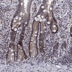 Anti-TCEAL1 Antibody