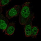 Immunofluorescent staining of human cell line PC-3 shows localization to nucleoplasm & nuclear bodies.