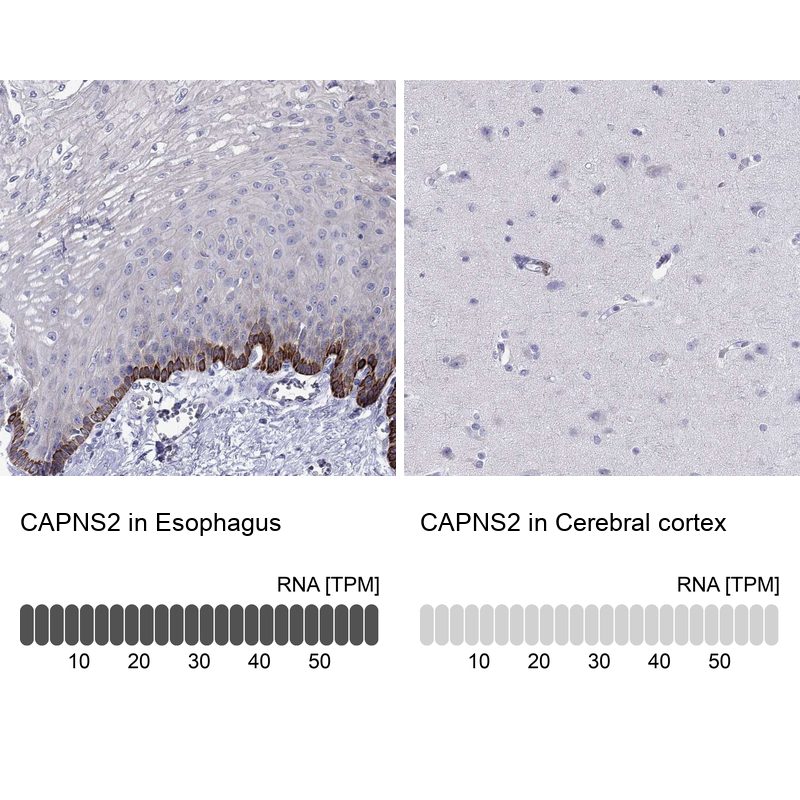 Anti-CAPNS2 Antibody