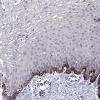 Immunohistochemical staining of human esophagus shows high expression.