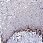 Immunohistochemical staining of human esophagus shows high expression.