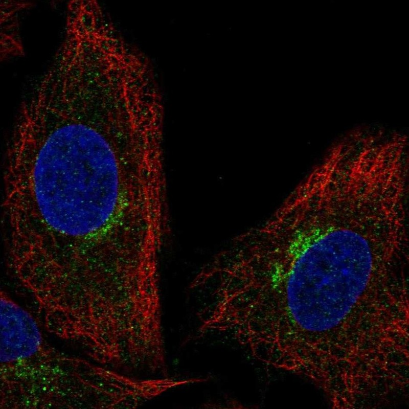 Anti-SLC6A16 Antibody