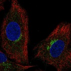 Anti-SLC6A16 Antibody