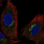 Anti-SLC6A16 Antibody