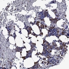 Immunohistochemical staining of human bone marrow shows strong cytoplasmic positivity in a subset of hematopoietic cells.