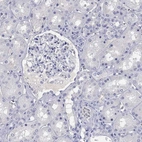 Immunohistochemical staining of human kidney shows no positivity in cells in tubules as expected.