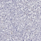 Immunohistochemical staining of human liver shows no positivity in hepatocytes as expected.
