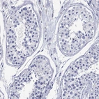 Immunohistochemical staining of human testis shows no positivity in cells in seminiferous ducts as expected.