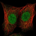 Anti-ZSCAN10 Antibody