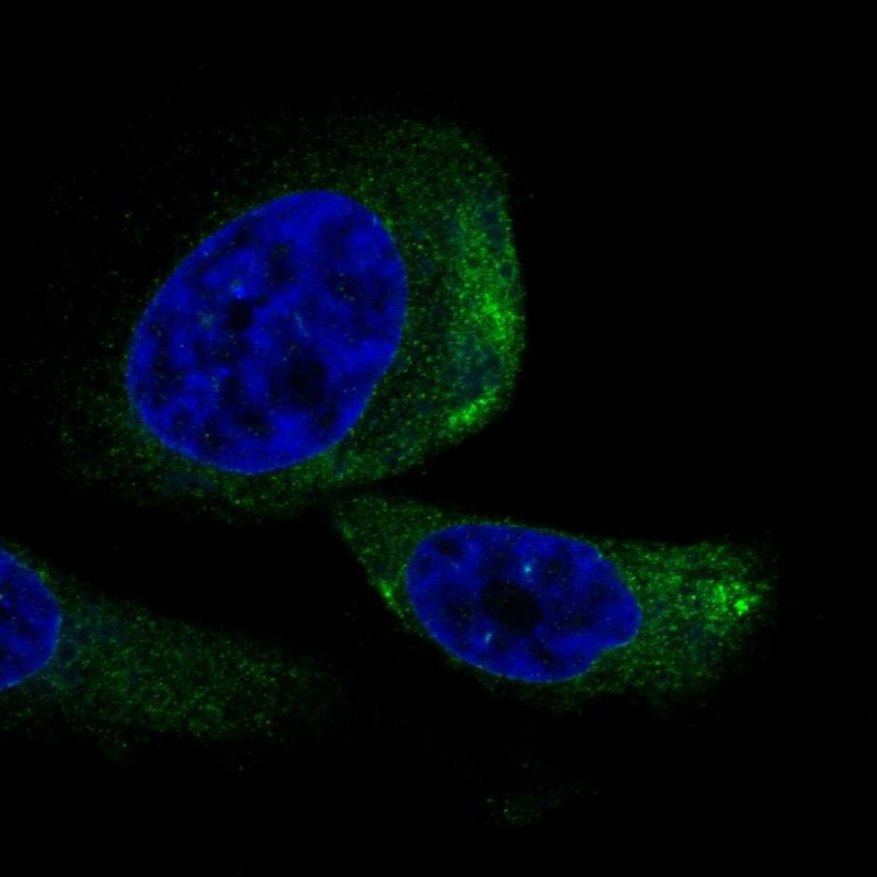 Anti-TRIQK Antibody