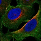 Anti-PALM2AKAP2 Antibody