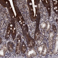 Anti-DHRS1 Antibody