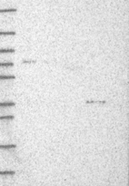 Lane 1: Marker [kDa] 250, 130, 95, 72, 55, 36, 28, 17, 10 | Lane 2: RT4 | Lane 3: U-251 MG | Lane 4: Human Plasma | Lane 5: Liver | Lane 6: Tonsil