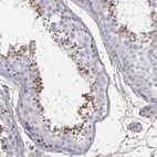 Immunohistochemical staining of human testis shows high expression.