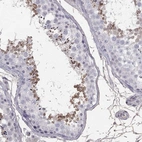 Immunohistochemical staining of human testis shows high expression.
