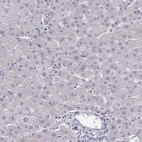 Immunohistochemical staining of human liver shows low expression as expected.