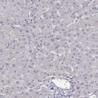 Immunohistochemical staining of human liver shows low expression as expected.
