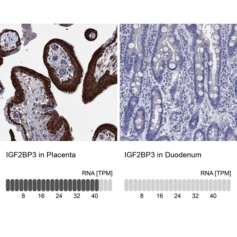 Anti-IGF2BP3 Antibody