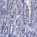 Immunohistochemical staining of human duodenum shows low expression as expected.