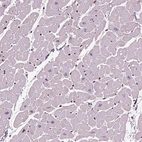 Immunohistochemical staining of human heart muscle shows moderate nuclear positivity in cardiomyocytes.