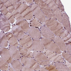 Immunohistochemical staining of human skeletal muscle shows moderate nuclear positivity in myocytes.