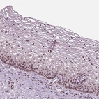 Immunohistochemical staining of human cervix, uterine shows moderate nuclear positivity in squamous epithelial cells.