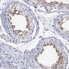 Anti-SPATA9 Antibody