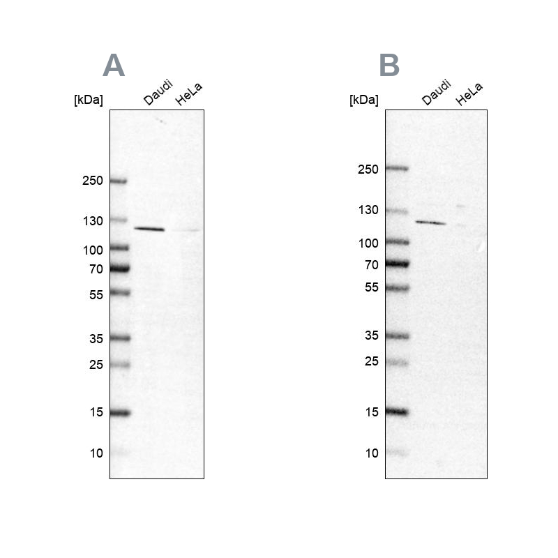 Anti-LEMD3 Antibody