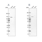 Anti-LEMD3 Antibody