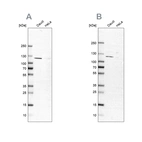 Anti-LEMD3 Antibody