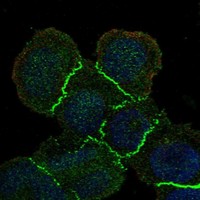 Anti-MAGI1 Antibody