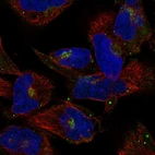 Immunofluorescent staining of human cell line RH-30 shows localization to the Golgi apparatus.