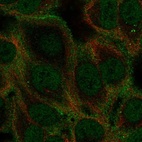 Anti-GABRA5 Antibody