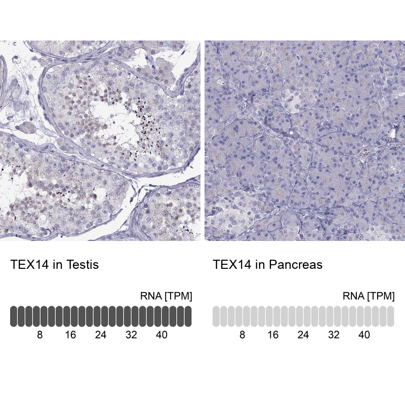 Anti-TEX14 Antibody