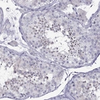 Immunohistochemical staining of human testis shows high expression.