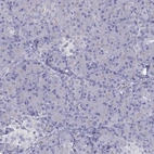 Immunohistochemical staining of human pancreas shows low expression as expected.
