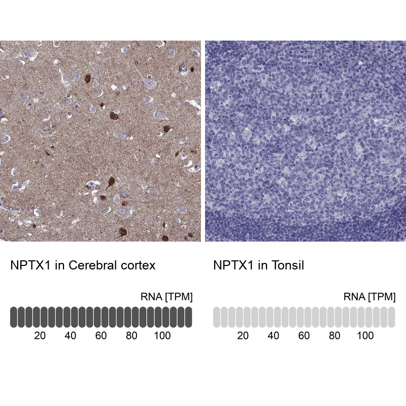 Anti-NPTX1 Antibody