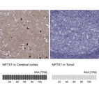 Anti-NPTX1 Antibody