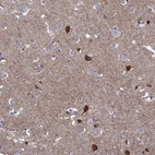 Immunohistochemical staining of human cerebral cortex shows high expression.
