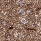 Immunohistochemical staining of human cerebral cortex shows strong synapse staining and cytoplasmic positivity in neuronal cells.