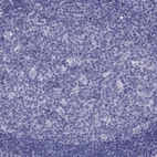 Immunohistochemical staining of human tonsil shows low expression as expected.