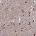 Anti-LMTK3 Antibody