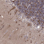 Immunohistochemical staining of human cerebellum shows moderate granular cytoplasmic positivity in Purkinje cells.
