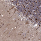 Immunohistochemical staining of human cerebellum shows moderate granular cytoplasmic positivity in Purkinje cells.