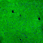 Immunofluorescence staining of mouse cerebral cortex shows strong cytoplasmic positivity in neuropil.